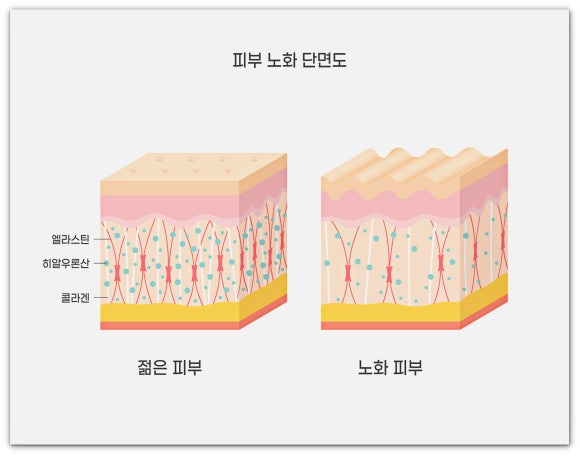 What Skin Types Is Jamsil Thermage Effective For? image 7