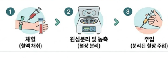 송파 줄기세포주사, 인위적인 느낌 없이 피부 자생력을 높이려면? 관련 이미지 5