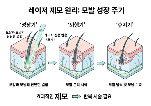 If you’re 고민ing about where to get the best Jamsil underarm hair removal image 2