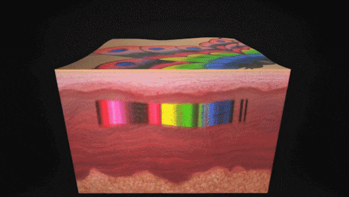 Jamsil Picosure Effects and Who It’s Recommended For (Including Tips to Lower the Cost) image 8