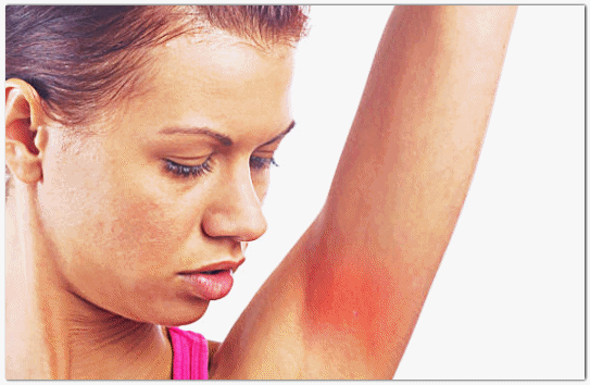 Underarm Toning Effects: How Do Idols Care for Their Underarms? image 4