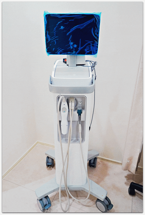 Jamsil Lifting: Not Sure Which Treatment to Choose? image 7