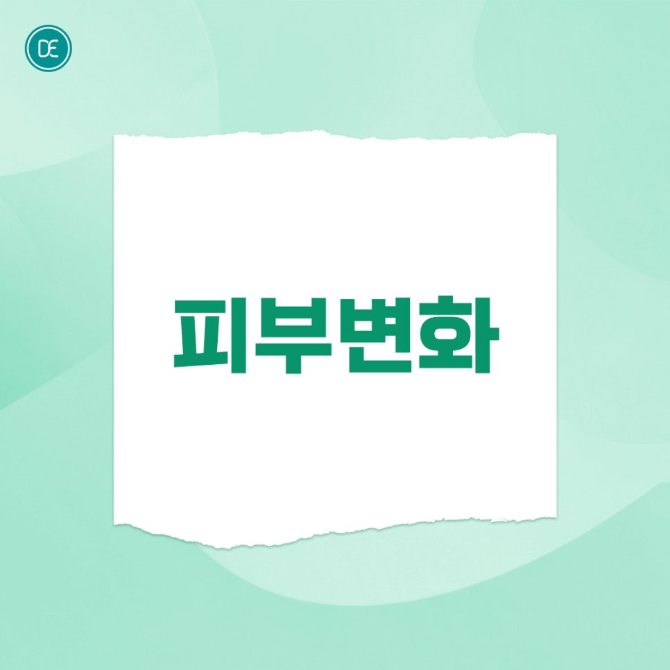 정발산 올리지오 구김살 해소 관련 이미지 3