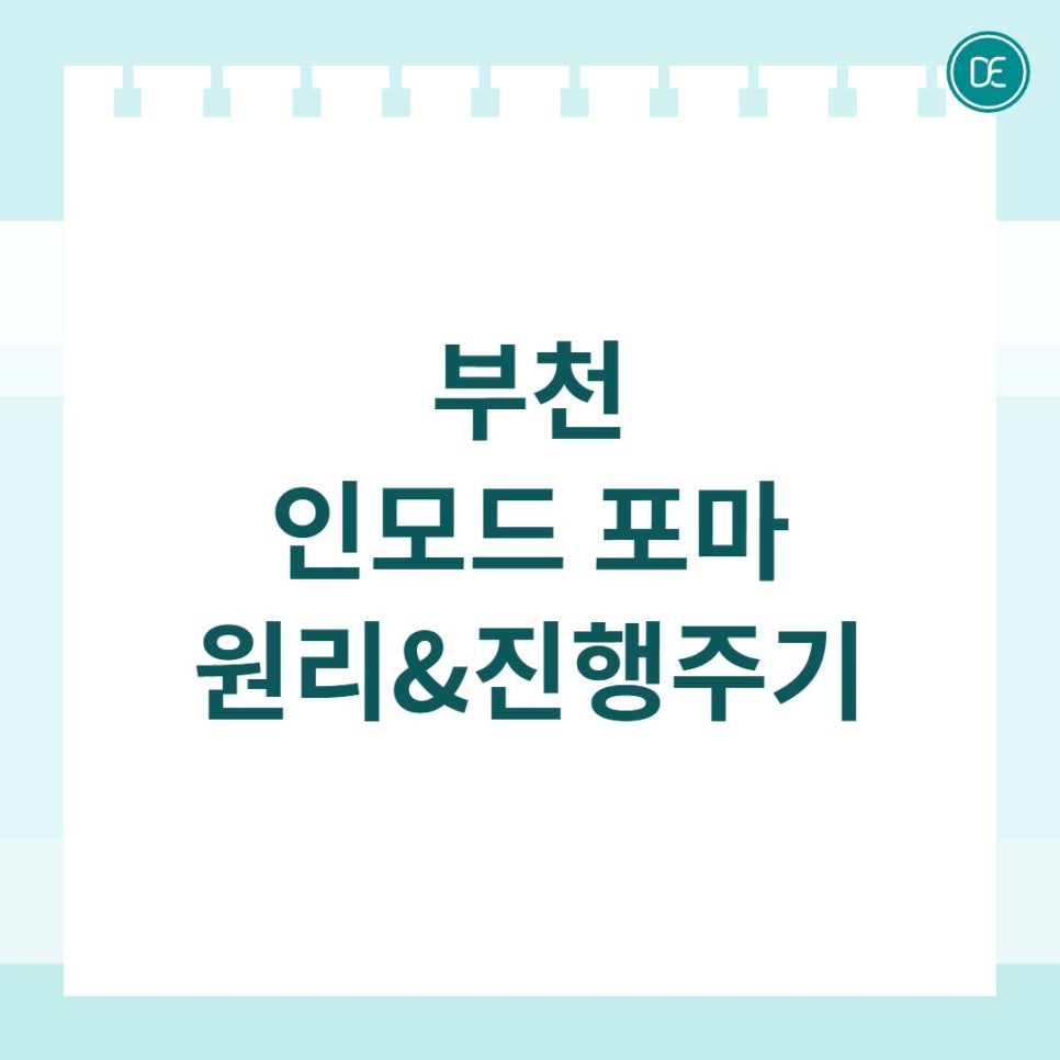부천 인모드포마 원리와 진행 주기 상세하게 알아보기 관련 이미지 1