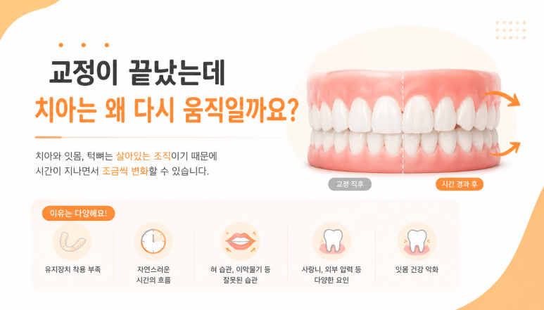 Achasan Station Dental Clinic: Why Do Teeth Shift Again After Orthodontic Treatment? image 2