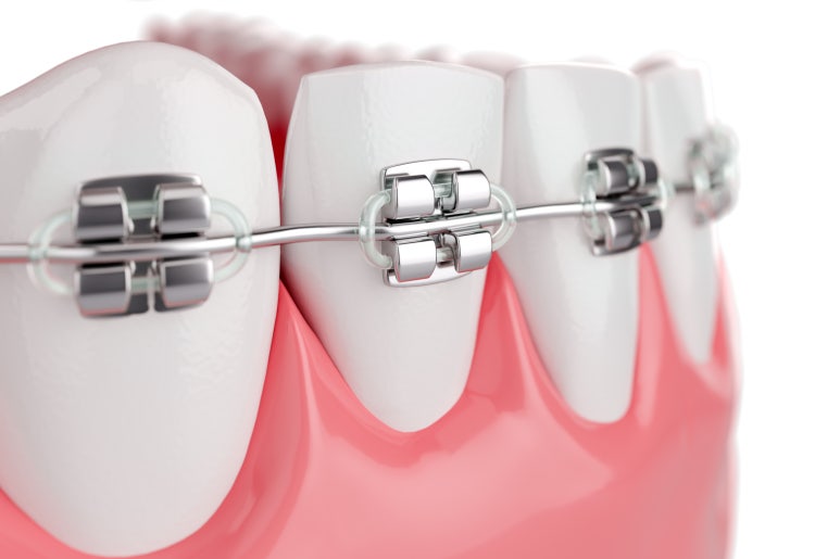 Are you looking for a trustworthy place for orthodontic treatment near Konkuk University Station? image 3
