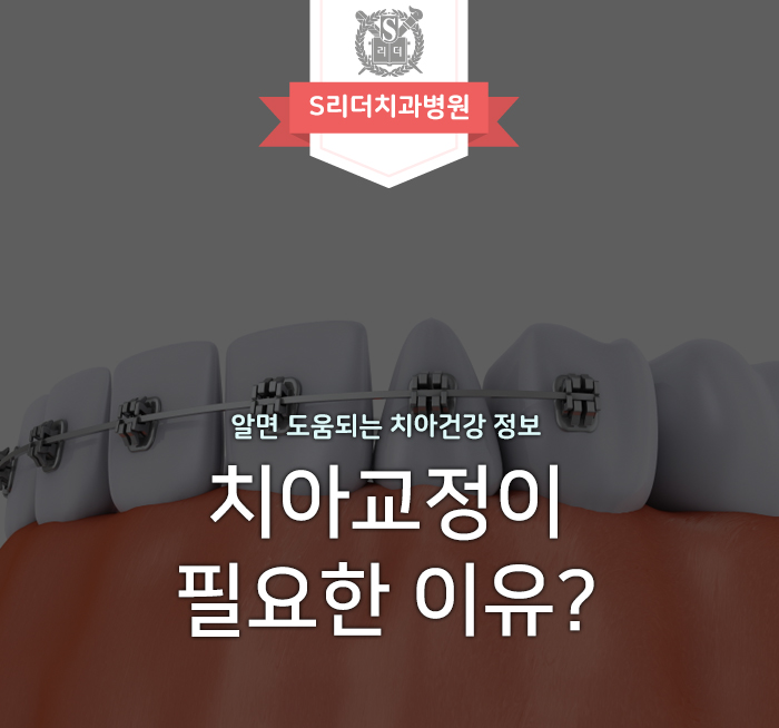 치아교정 필요한 이유 겉모습 때문만이 아닌 이유 관련 이미지 1