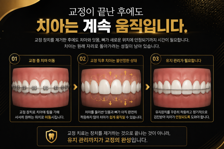 광장동치과 교정 후 다시 틀어지는 이유와 재교정이 필요한 경우 관련 이미지 2