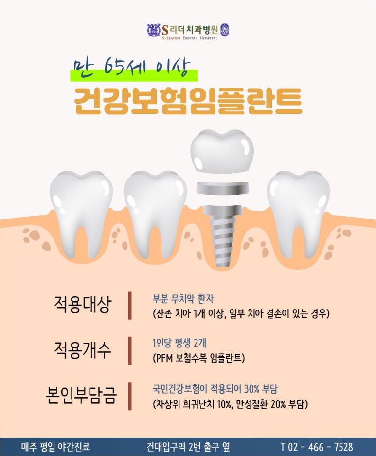 광장동치과 임플란트건강보험 적용 대상은 누구일까 관련 이미지 3