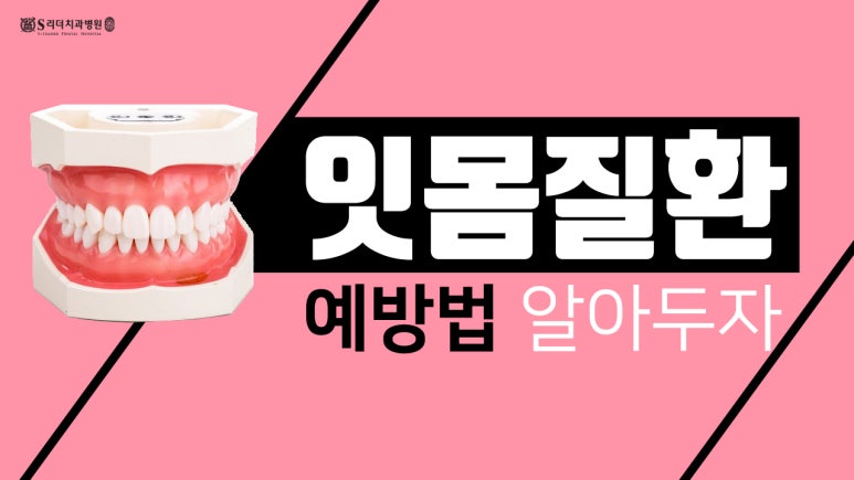 건대입구치과 | 잇몸병은 왜 조용히 진행될까? 초기 신호 체크리스트 10가지 관련 이미지 9