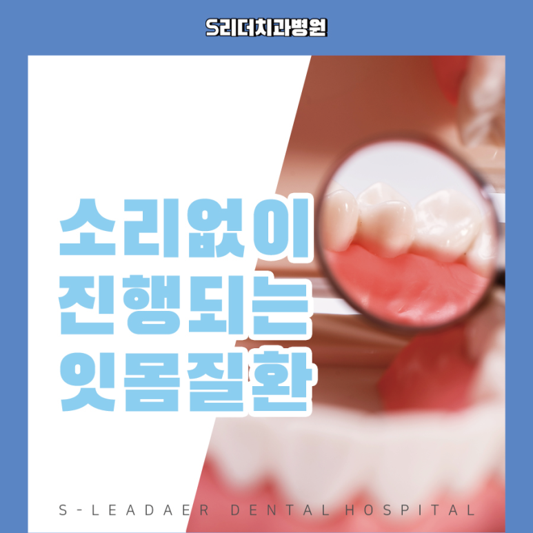 서울치과추천 | 잇몸치료란 무엇인가요? 꼭 필요한 시기부터 치료 과정까지 관련 이미지 4