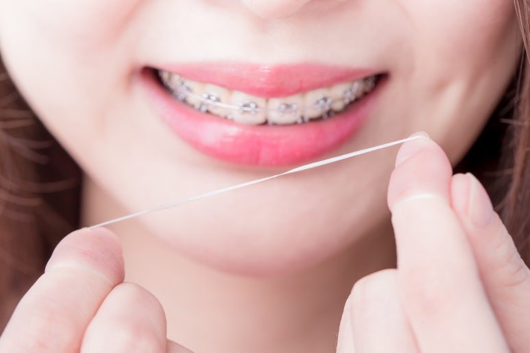 Gwangjin-gu Dental Clinic with Evening Hours: Why Teeth May Feel Spaced After Orthodontic Treatment image 6