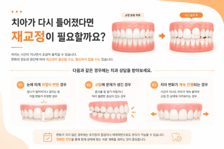 Achasan Station Dental Clinic: Why Do Teeth Shift Again After Orthodontic Treatment? image 6