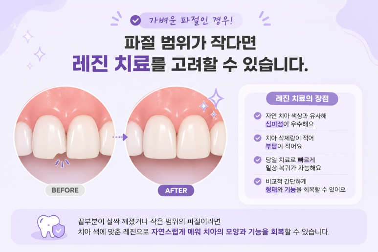 군자동치과 앞니 여러 개가 동시에 깨졌다면? 치아마다 치료 방법이 다른 이유 관련 이미지 4