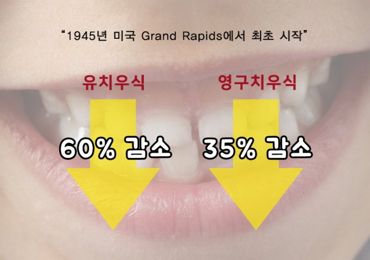 광진구치과추천 수돗물속 불소의 효과 관련 이미지 4
