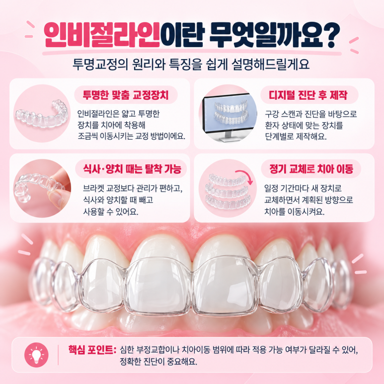 중곡동치과 인비절라인, 모든 부정교합에 적용할수 있을까? 관련 이미지 2