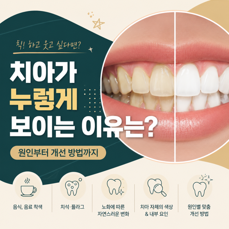 중곡역치과 치아가 누렇게 보이는 이유는? 원인부터 개선 방법까지 관련 이미지 1