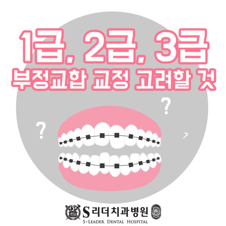 구의동치과 부정교합교정기간 교정학박사가 상주하는 곳에서 관련 이미지 1