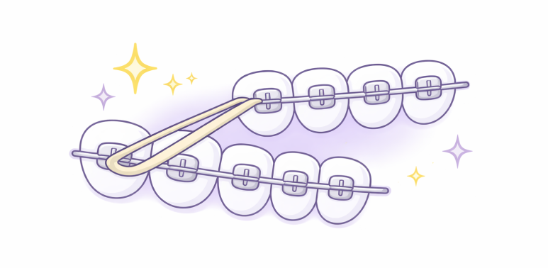 Gwangjin-gu Dental Clinic Recommendation: How Important Is the Elastic Stage in Orthodontic Treatment for Improving Protruding Mouths? image 2