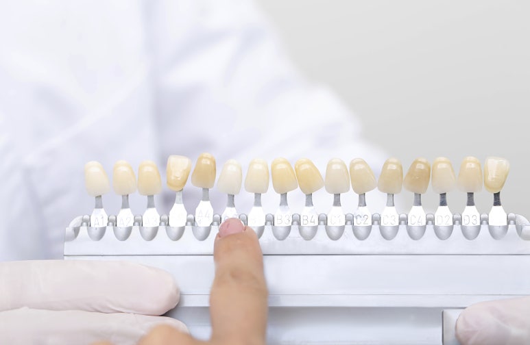 Seoul Yangsim Dental Clinic Laminate &middot; Orthodontic Treatment: Which Procedure Is Right for Me? image 5