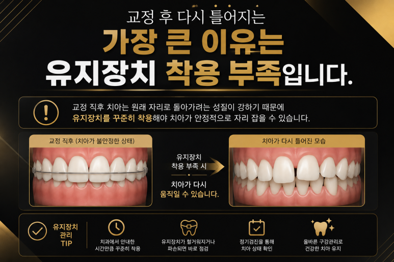광장동치과 교정 후 다시 틀어지는 이유와 재교정이 필요한 경우 관련 이미지 3