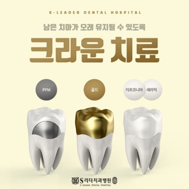 성동구치과 보철물탈락원인 대처법 에스리더치과병원에서! 관련 이미지 5
