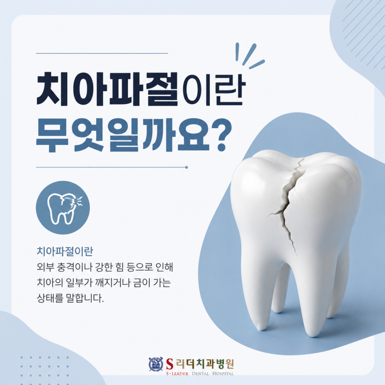 군자역치과 치아가 깨졌다면? 치아파절 원인부터치료까지 관련 이미지 2