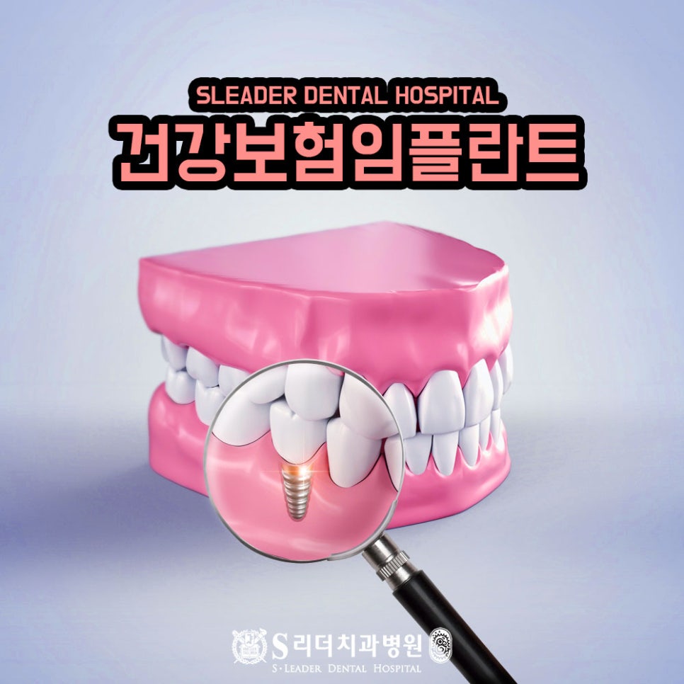 중곡역치과 외국인임플란트는 잘 알아보세요 관련 이미지 16