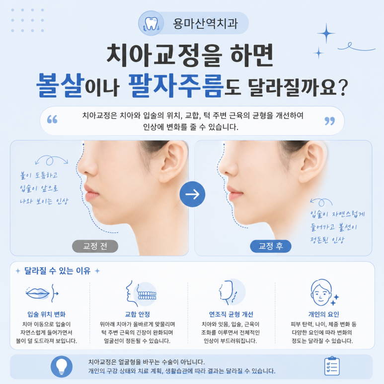 용마산역치과, 치아교정 후 얼굴형은 정말 달라질까요? 관련 이미지 7