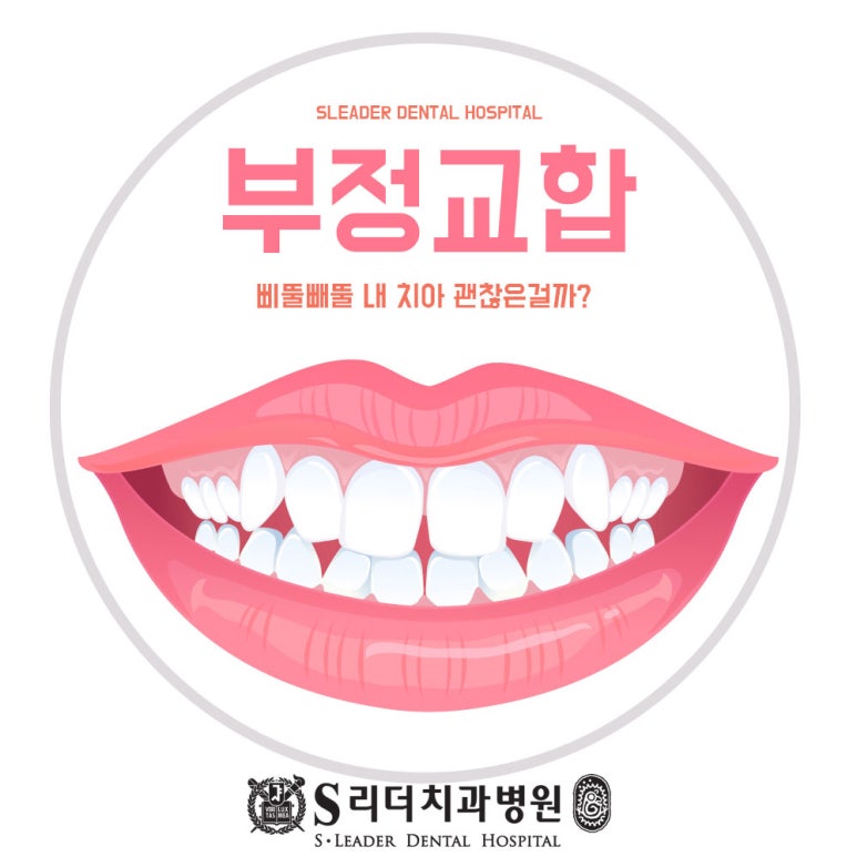 건대치아교정 부정교합치아교정 건대입구역 잘하는곳 알아본다면 관련 이미지 1