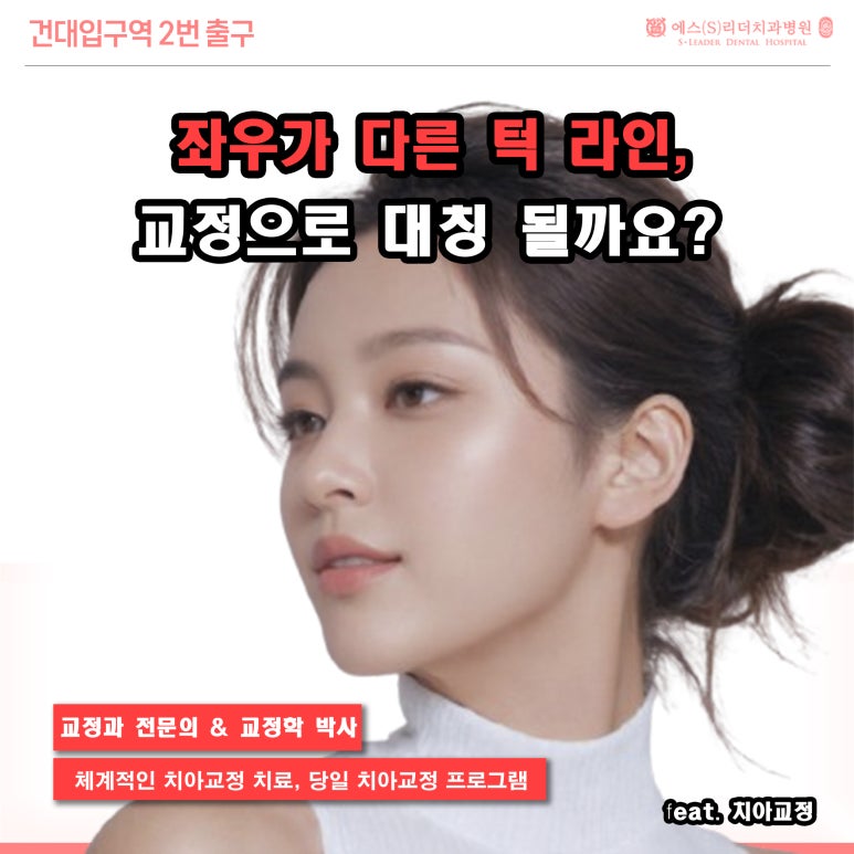 [송정동치과] 턱이 삐뚤어 보인다면? 턱 비대칭 교정치료로 가능한가요 관련 이미지 1