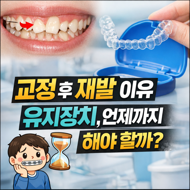 송정동치과에서 알려주는 교정 후 재발 이유｜유지장치, 언제까지 해야 할까? 관련 이미지 1
