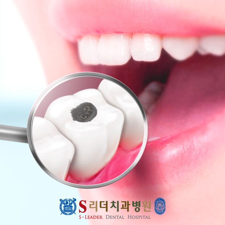 면목역치과 구강검진수검률 매해 살펴보면 관련 이미지 17