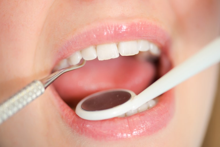 [Guwi Station Dental Clinic] Can Partial Orthodontic Treatment for Canine Teeth Be Done in 6 Months? image 2