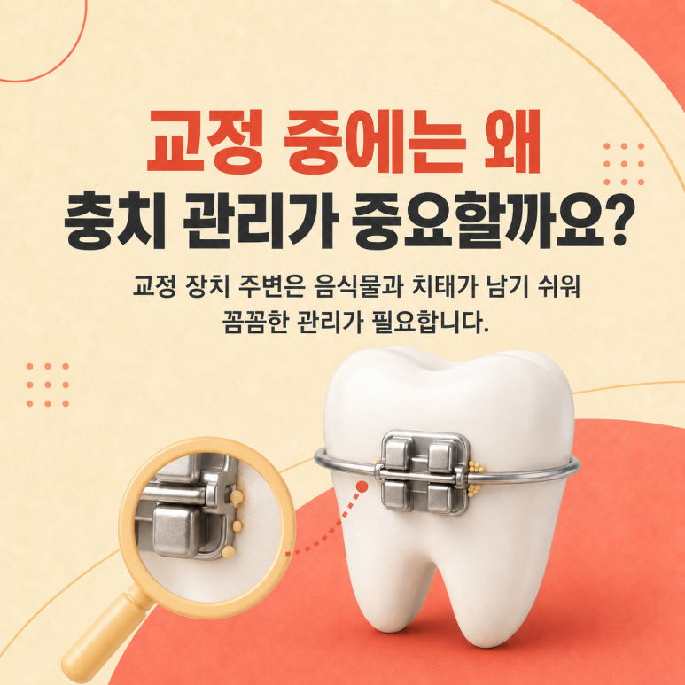 건대교정치과, 교정 장치 주변에는 왜 충치가 생기기 쉬울까요? 예방법까지 관련 이미지 2