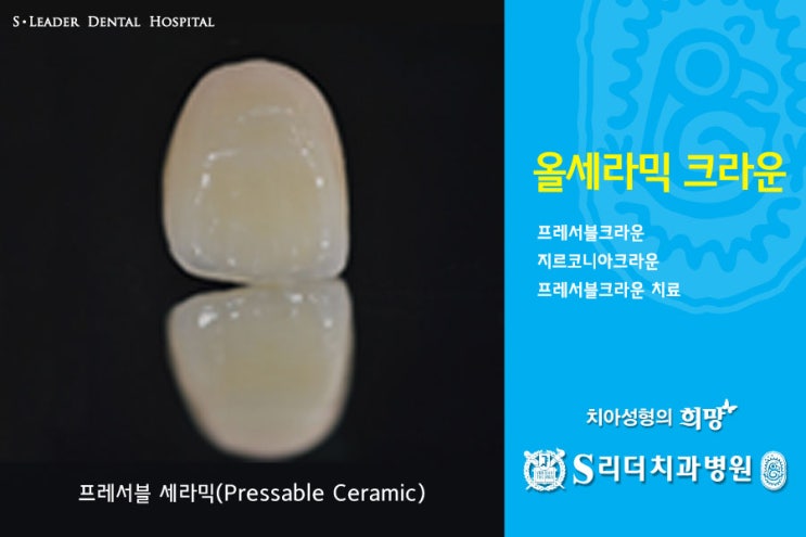 건대치과 치아성형 잘하는 곳 궁금해? 관련 이미지 5