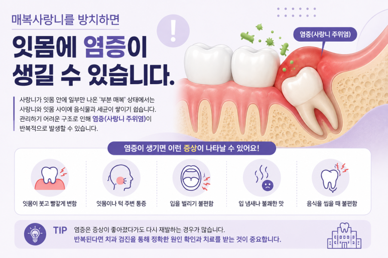 구의동치과 매복 사랑니를 오래 방치하면 어떤 문제가 생길까요? 관련 이미지 3