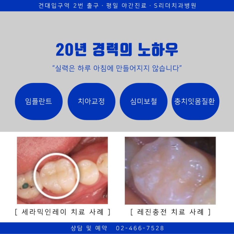 Guwi-dong Dental Clinic: Can Cavities Develop Even After Crown Treatment? image 8