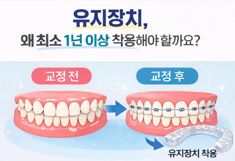 Myeonmok-dong Dental Clinic Tells You – Why You Should Wear Your ‘Retainer’ for at Least 1 Year After Orthodontic Treatment image 2