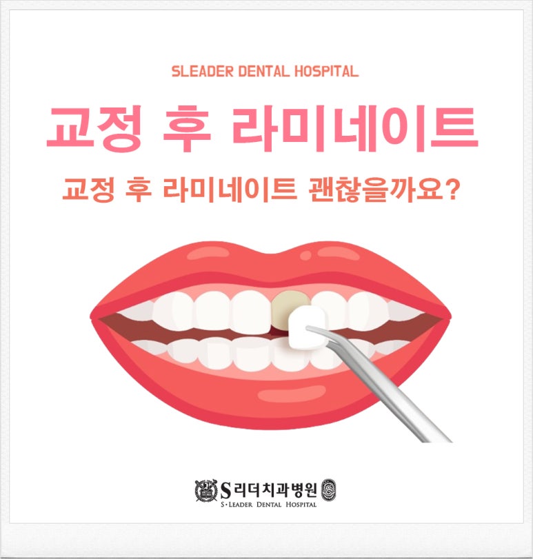 Sagajeong Station Dental Clinic, Make It Even More Perfect with Laminates After Orthodontic Treatment! image 1