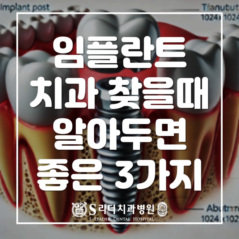 자양동 임플란트치과 찾기 전 알아두면 좋은 3가지는? 관련 이미지 1