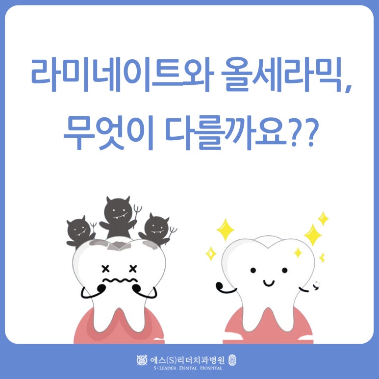 Sanggye-dong Dental Clinic, What Is the Difference Between Laminate and All-Ceramic? image 1