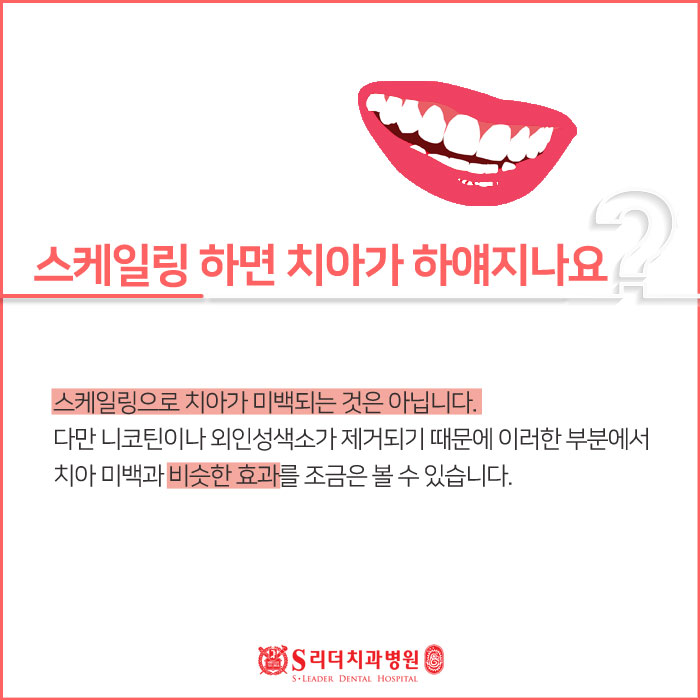 건대스케일링 보험부터 효과까지 알아보기 관련 이미지 3
