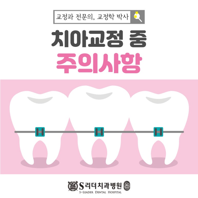 건대입구역치과 치아교정 시작 전 체크리스트는?? 관련 이미지 5