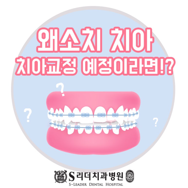 서울치과추천 왜소치치아교정치과 광진구 알아본다면 관련 이미지 1