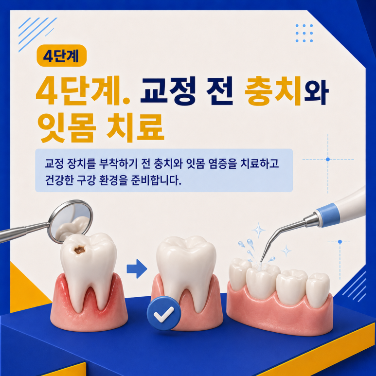 군자역치과 치아교정은 어떤 순서로 진행될까요? 단계별 과정 정리 관련 이미지 5