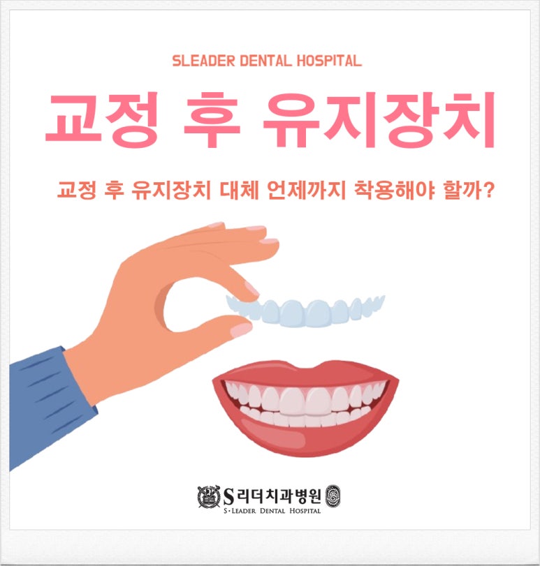 Guwi Station Dental Clinic: After Orthodontics, How Long Should You Wear a Retainer? image 1