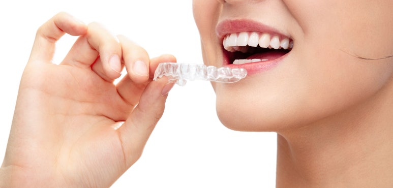 Seongsu-dong Dental Clinic: Why Is an Orthodontic Retainer Important? image 3