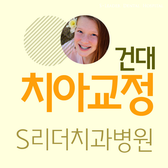 건대치아교정치과 수준높은 치아교정이 되려면 관련 이미지 1