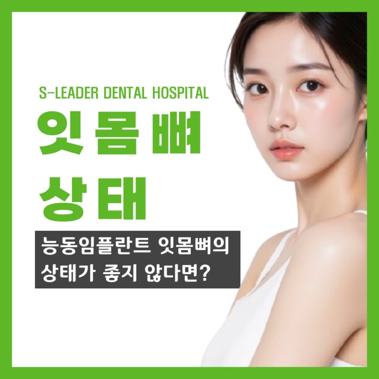 능동임플란트 잇몸뼈의 상태가 좋지 않다면? 관련 이미지 1